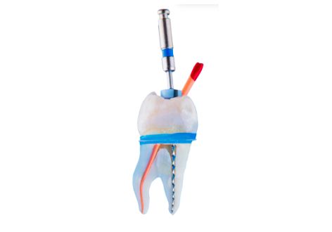 ENDODONCIA UNIRRADICULAR